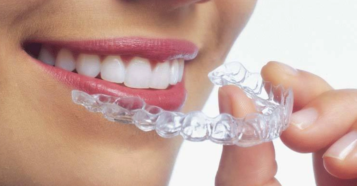Invisalign in Turkey Inblog